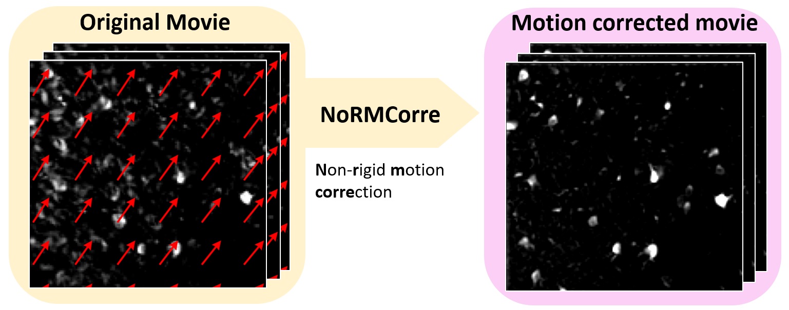 motion correction workflow 